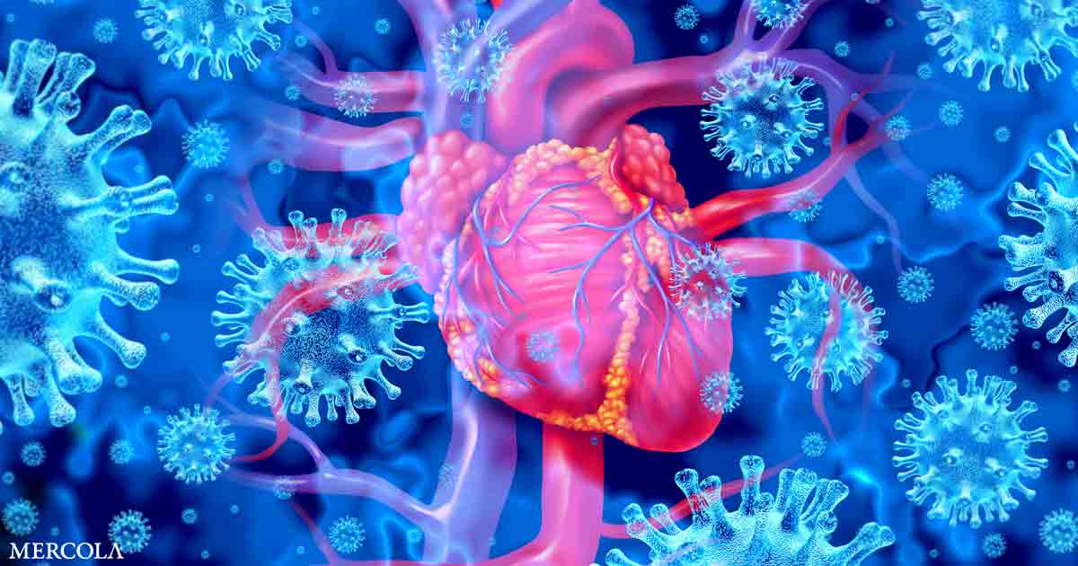 Study: Pfizer Vaccine Increases Myocarditis Threefold