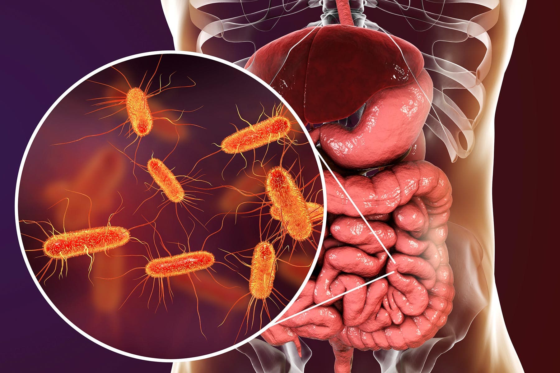 Too Many Antibiotics Might Raise Colon Cancer Risk